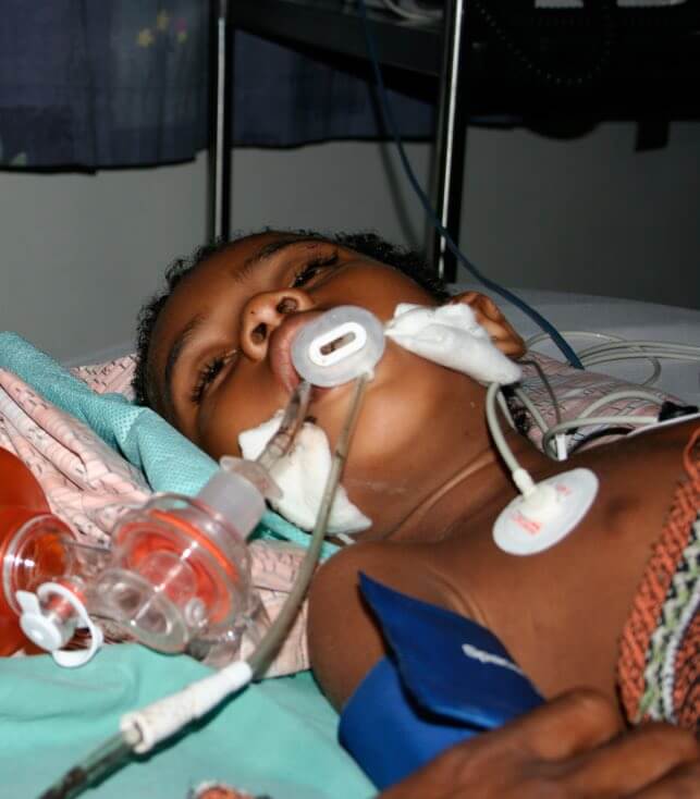 Young boy lying in a hospital bed and breathing on a respirator following a snakebite
