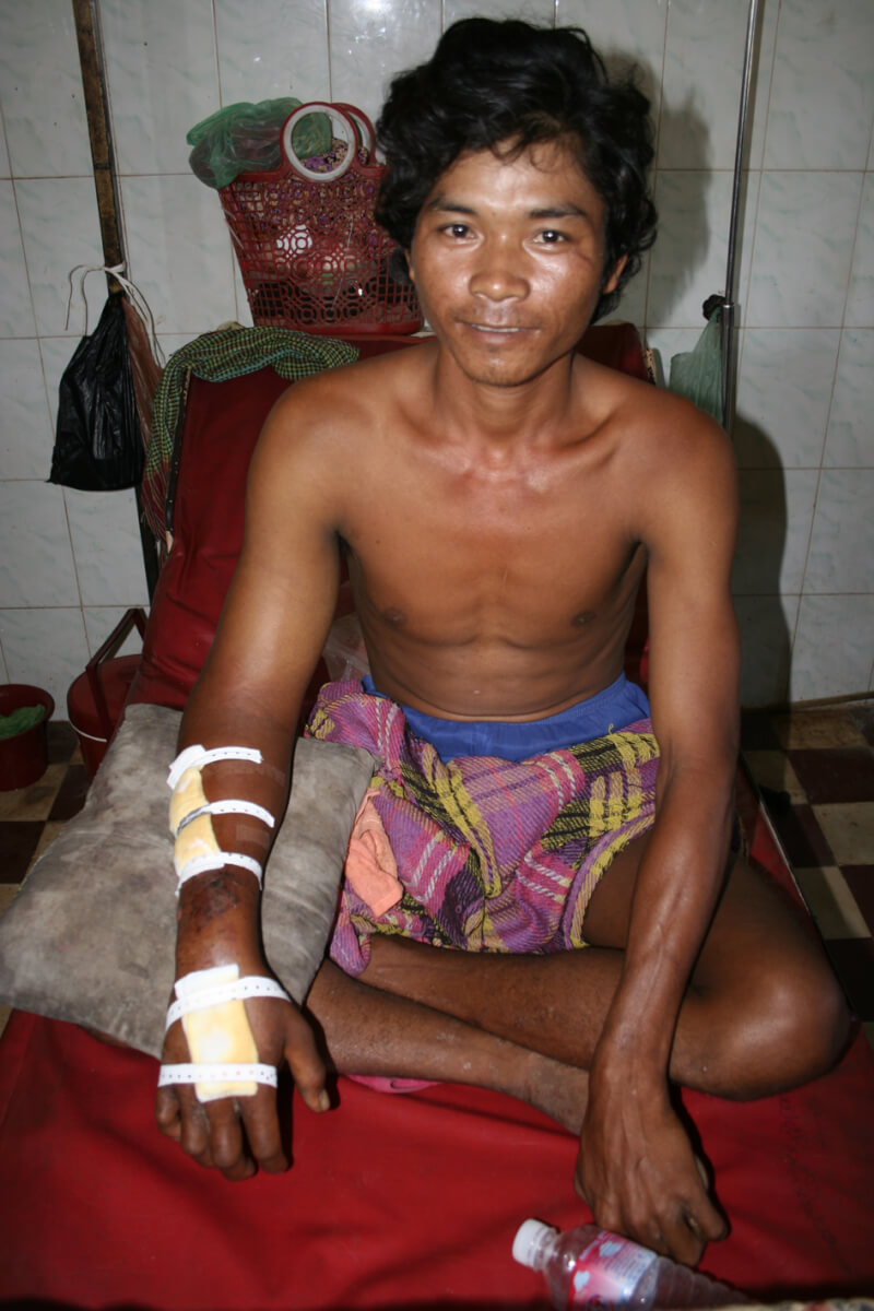 Shirtless man sits on a cot with a bandaged arm.